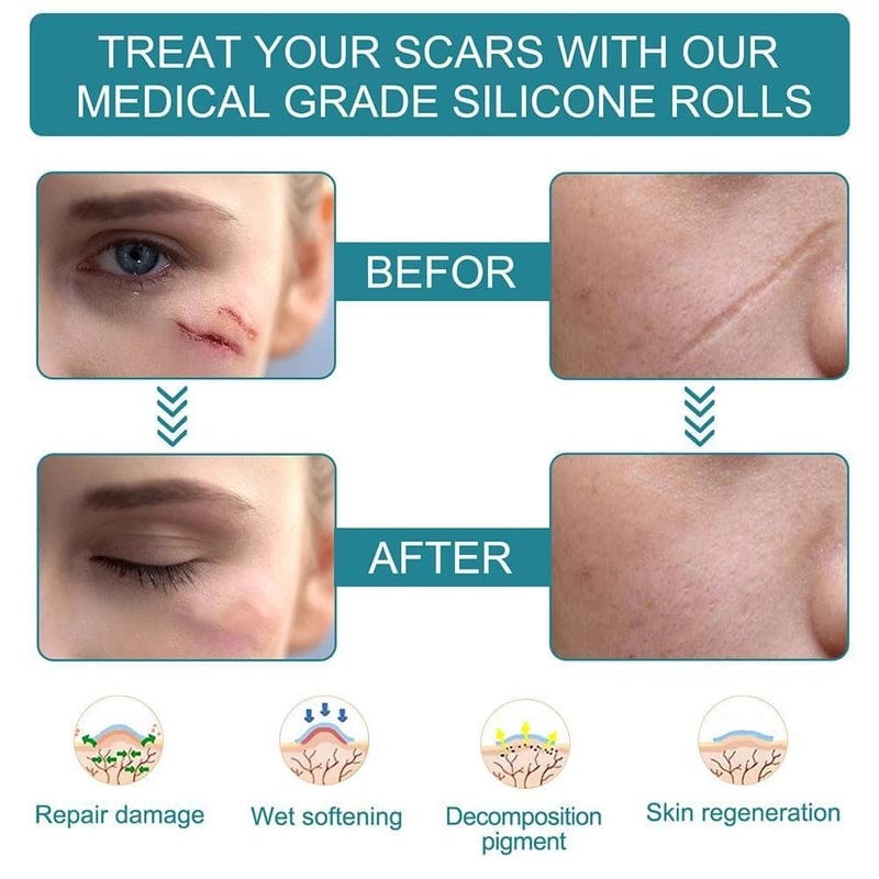 Dermoxy™ Scar Removal Tape
